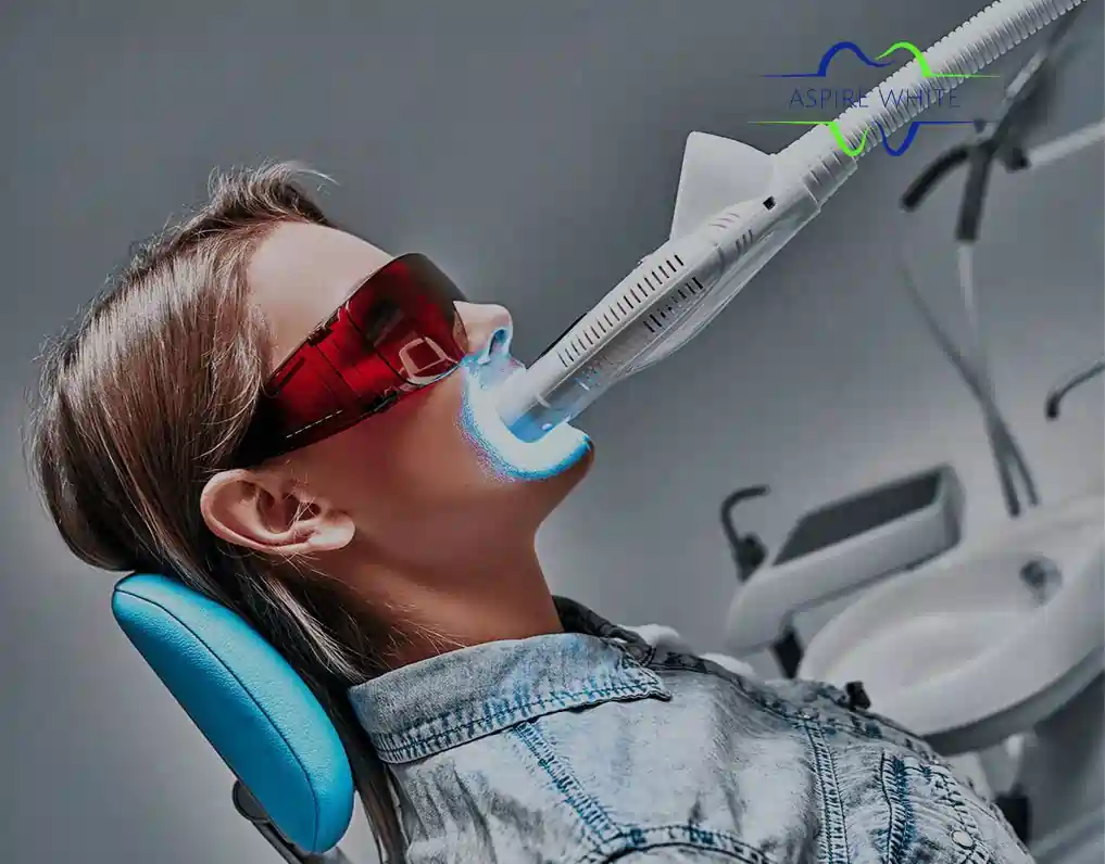 1 Hour Teeth Whitening with Aspire White Oldham
