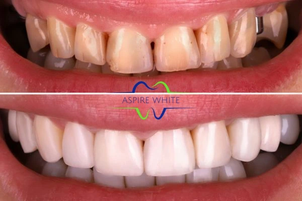Before And After Results Oldham