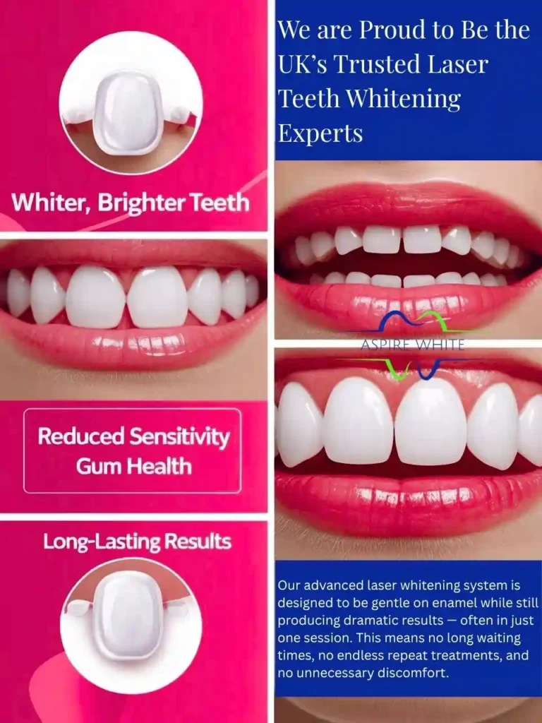 We are Proud to Be the UK’s Trusted Laser Teeth Whitening Experts Oldham